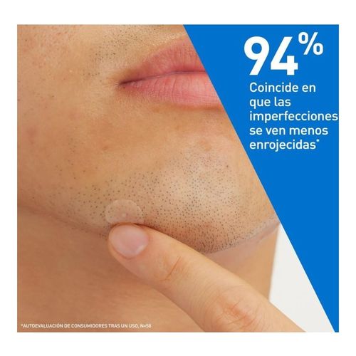 Patches Control de Imperfeições