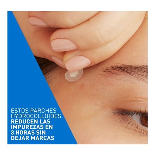 Patches Control de Imperfeições