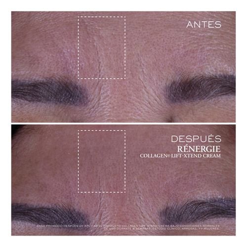 R&eacute;nergie Collagen+ Lift-Xtend Cream