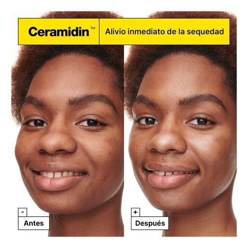 Ceramidin Skin Barrier