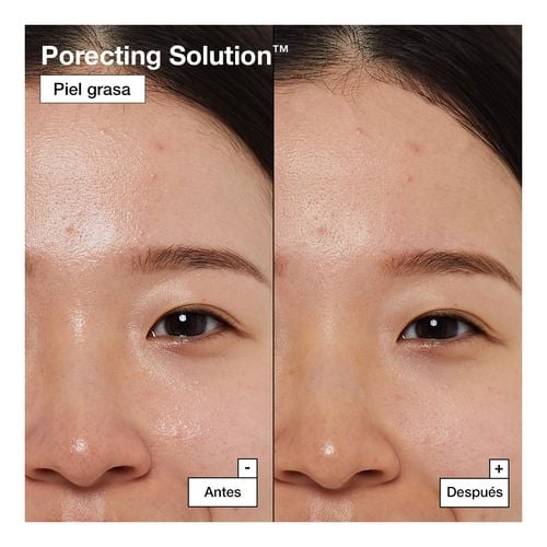 Dermask Porecting SolutionTM