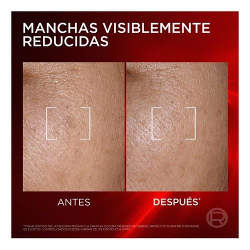 Revitalift Laser Triple Antiedad