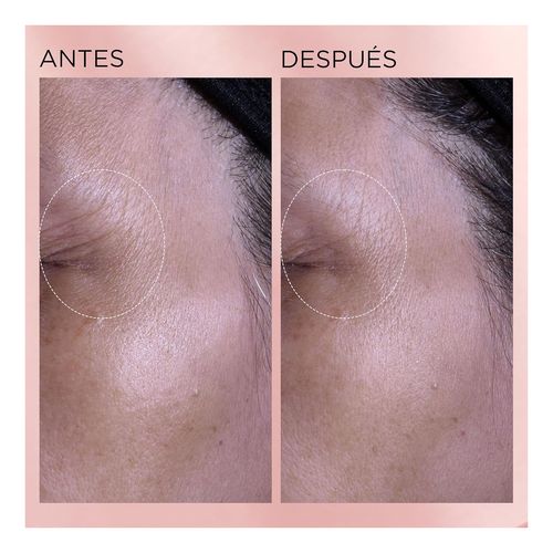 Retinol + HPR Ceramide Rapid Skin Renewing