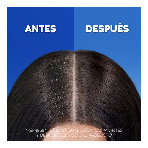 Prevenci&oacute;n Ca&iacute;da