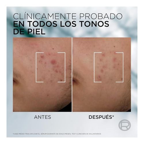 Men Expert Derma Control Serum