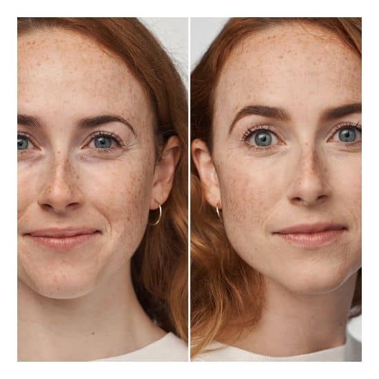 Even Better Clinical SPF20