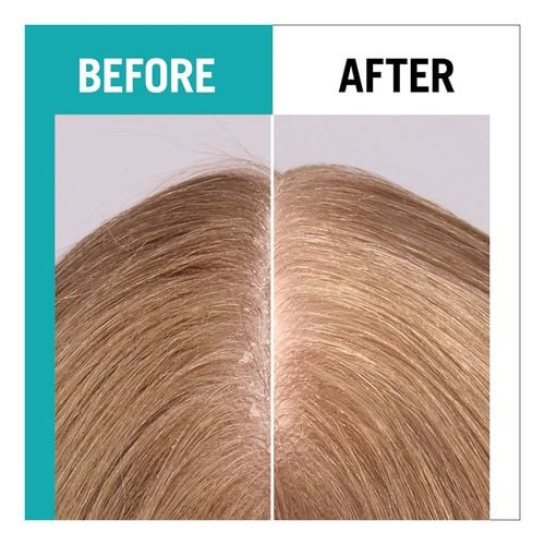 Scalp Balance Sun Protect