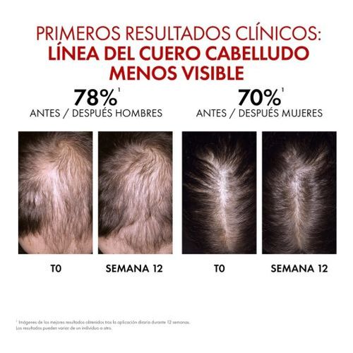 Dercos Aminexil Clinical R.E.G.E.N. Booster