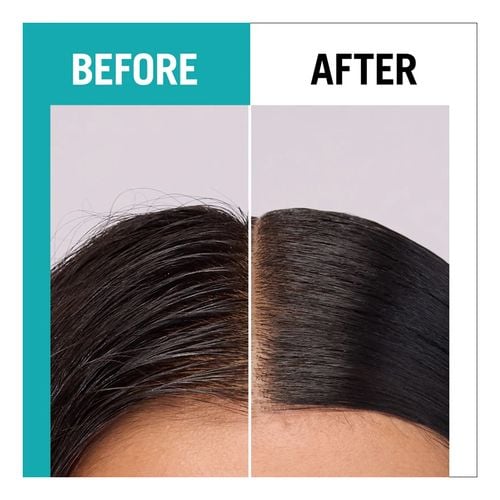 Scalp Balance Champ&uacute;
