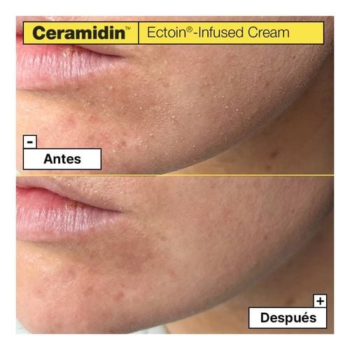 Ceramidin Ectoin-Infused Cream