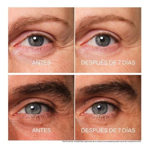 ABEILLE ROYALE TRATAMENTO DE OLHOS