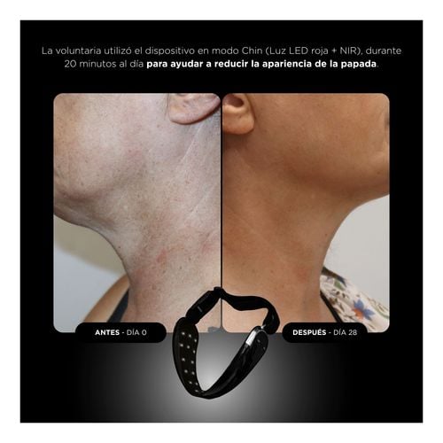 Unicled Neck & Chin