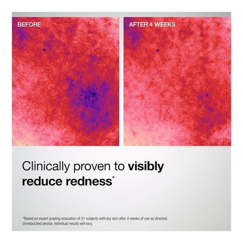 Barrier Restore + Soothing Cream