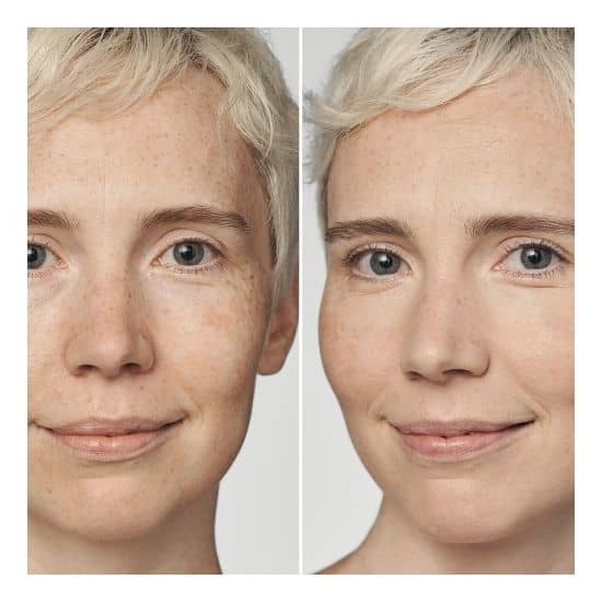 Even Better Clinical SPF20