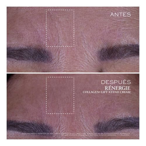 R&eacute;nergie Collagen+ Lift-Xtend Cream