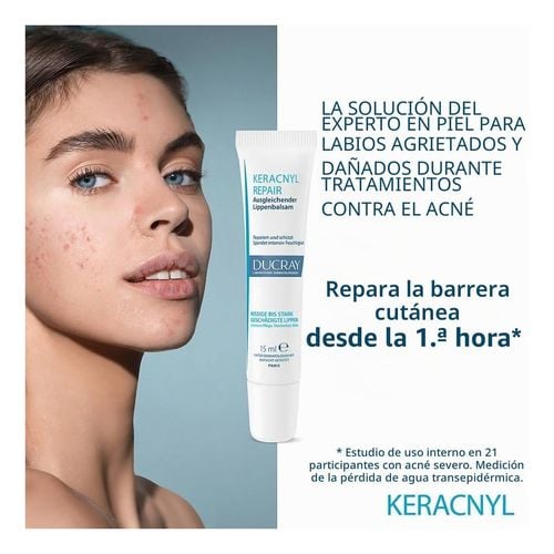 Keracnyl Repair B&aacute;lsamo Labial