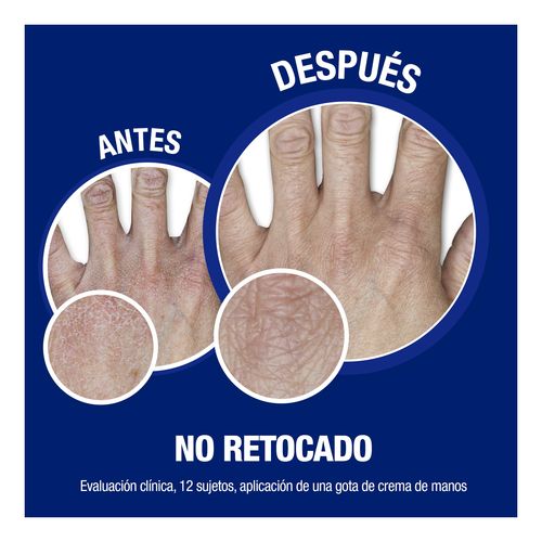 Manos Rápida Absorción