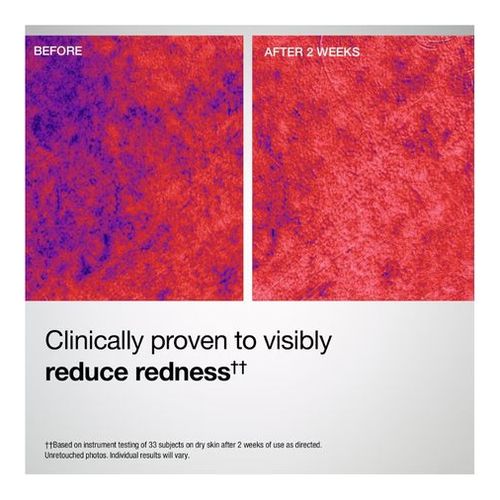 Barrier Restore + Soothing Mist